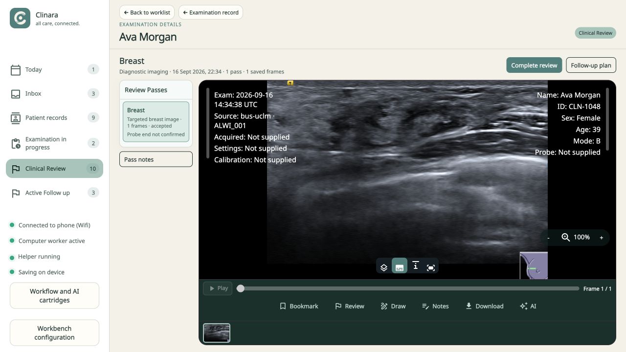 Clinara Workbench desktop interface reviewing an ultrasound pass from a demonstration patient examination